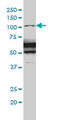 RAS P21 Protein Activator 1 antibody, LS-C133082, Lifespan Biosciences, Western Blot image 