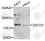 Glutathione S-Transferase C-Terminal Domain Containing antibody, A7187, ABclonal Technology, Western Blot image 