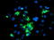 E3 ubiquitin-protein ligase TRIM9 antibody, M08967, Boster Biological Technology, Immunofluorescence image 