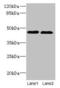 Potassium Two Pore Domain Channel Subfamily K Member 13 antibody, CSB-PA862058LA01HU, Cusabio, Western Blot image 