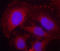 Phospholipase C Gamma 1 antibody, LS-C335937, Lifespan Biosciences, Immunofluorescence image 
