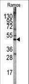 Serine/Threonine Kinase 11 antibody, LS-C100775, Lifespan Biosciences, Western Blot image 