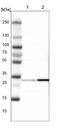 Carbonyl Reductase 3 antibody, NBP1-87065, Novus Biologicals, Western Blot image 