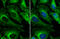Clathrin Heavy Chain antibody, GTX132976, GeneTex, Immunocytochemistry image 
