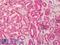 Caspase 6 antibody, LS-B1345, Lifespan Biosciences, Immunohistochemistry paraffin image 