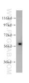 Interleukin 7 Receptor antibody, 17626-1-AP, Proteintech Group, Western Blot image 