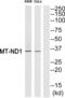 Mitochondrially Encoded NADH:Ubiquinone Oxidoreductase Core Subunit 1 antibody, abx014637, Abbexa, Western Blot image 