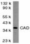 DNA fragmentation factor subunit beta antibody, 2416, QED Bioscience, Western Blot image 