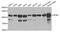 Adaptor Related Protein Complex 2 Subunit Beta 1 antibody, AHP2433, Bio-Rad (formerly AbD Serotec) , Western Blot image 