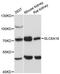Solute Carrier Family 6 Member 18 antibody, LS-C747927, Lifespan Biosciences, Western Blot image 