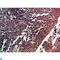 Tenascin R antibody, LS-C813939, Lifespan Biosciences, Immunohistochemistry paraffin image 