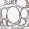 COMM Domain Containing 8 antibody, NBP1-82178, Novus Biologicals, Immunohistochemistry paraffin image 