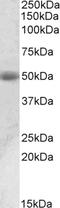 Acid Phosphatase, Prostate antibody, EB10915, Everest Biotech, Western Blot image 