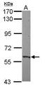 Zinc Finger Protein 417 antibody, PA5-31844, Invitrogen Antibodies, Western Blot image 