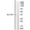 Solute Carrier Family 15 Member 1 antibody, A03672, Boster Biological Technology, Western Blot image 