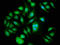 Polo Like Kinase 1 antibody, LS-C397140, Lifespan Biosciences, Immunofluorescence image 