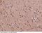 Microtubule Associated Protein RP/EB Family Member 3 antibody, 14614-T08, Sino Biological, Immunohistochemistry frozen image 