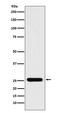 Peroxiredoxin 3 antibody, M02680, Boster Biological Technology, Western Blot image 