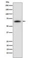 SUMO Specific Peptidase 2 antibody, M02329-2, Boster Biological Technology, Western Blot image 