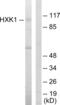 Hexokinase 1 antibody, abx013419, Abbexa, Western Blot image 