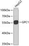 Glypican-1 antibody, 19-201, ProSci, Western Blot image 