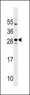 Transmembrane Protein 125 antibody, LS-C158279, Lifespan Biosciences, Western Blot image 