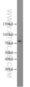 Small Ubiquitin Like Modifier 1 antibody, 10329-1-AP, Proteintech Group, Western Blot image 