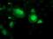 Spermine Synthase antibody, MA5-25590, Invitrogen Antibodies, Immunocytochemistry image 