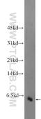 Galanin Like Peptide antibody, 25116-1-AP, Proteintech Group, Western Blot image 