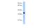 DND MicroRNA-Mediated Repression Inhibitor 1 antibody, PA5-41963, Invitrogen Antibodies, Western Blot image 