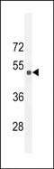 Sestrin 2 antibody, PA5-49582, Invitrogen Antibodies, Western Blot image 
