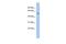 Potassium Voltage-Gated Channel Subfamily A Member 1 antibody, PA5-40991, Invitrogen Antibodies, Western Blot image 