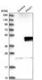 PIN2 (TERF1) Interacting Telomerase Inhibitor 1 antibody, NBP1-83643, Novus Biologicals, Western Blot image 