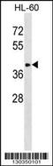 Alpha-2,8-sialyltransferase 8F antibody, 58-644, ProSci, Western Blot image 