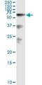 Hyaluronan Binding Protein 2 antibody, H00003026-M01, Novus Biologicals, Immunoprecipitation image 
