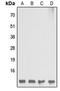 Diazepam Binding Inhibitor, Acyl-CoA Binding Protein antibody, LS-C355992, Lifespan Biosciences, Western Blot image 