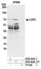 Lymphocyte Cytosolic Protein 2 antibody, A305-243A, Bethyl Labs, Immunoprecipitation image 