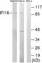 Interferon Gamma Inducible Protein 16 antibody, TA314052, Origene, Western Blot image 