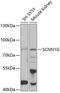 Sodium Channel Epithelial 1 Gamma Subunit antibody, 22-017, ProSci, Western Blot image 