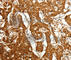Cadherin Related 23 antibody, A2785, ABclonal Technology, Immunohistochemistry paraffin image 