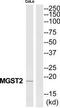 Microsomal Glutathione S-Transferase 2 antibody, TA314193, Origene, Western Blot image 