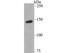 Tyrosine Kinase 2 antibody, NBP2-76968, Novus Biologicals, Western Blot image 