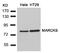 Myristoylated Alanine Rich Protein Kinase C Substrate antibody, 79-599, ProSci, Western Blot image 