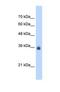 Stromal Cell Derived Factor 4 antibody, NBP1-69311, Novus Biologicals, Western Blot image 