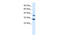 TAL BHLH Transcription Factor 1, Erythroid Differentiation Factor antibody, 31-244, ProSci, Western Blot image 