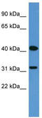 Olfactory receptor OR6-13 antibody, TA342741, Origene, Western Blot image 