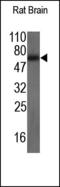 Transforming Growth Factor Beta Receptor 2 antibody, 250880, Abbiotec, Western Blot image 