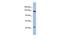 Slit Guidance Ligand 1 antibody, GTX44819, GeneTex, Western Blot image 