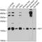 Insulin Like Growth Factor 1 antibody, GTX64353, GeneTex, Western Blot image 