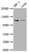Interferon Induced With Helicase C Domain 1 antibody, CSB-RA963423A0HU, Cusabio, Western Blot image 
